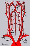 th_Blood_to_Brain.jpg?t=1329318888