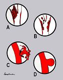 th_Thrombus_Artery.jpg?t=1329318890